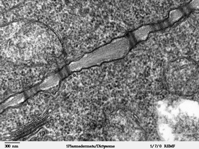 Figure 1.4. Plasmodesmata passing through the cell wall in a TEM of a Coleus blumei shoot apex.