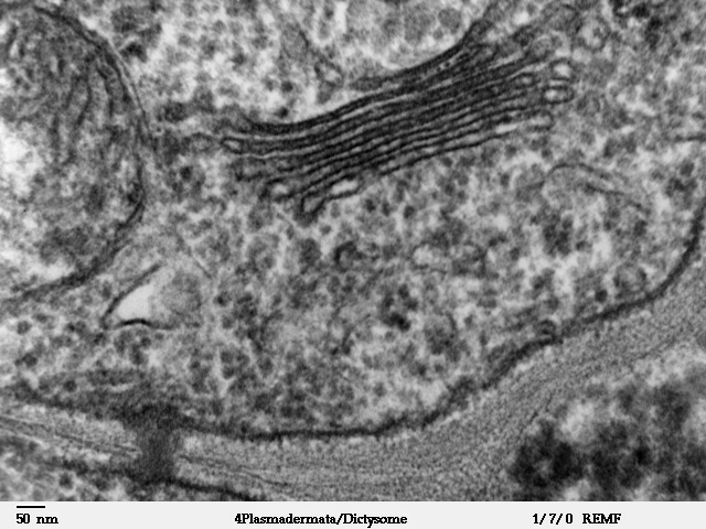 Figure 1.19.b. Transmission electron micrograph (TEM) of golgi apparatus showing central membrane bound structure and the vesicles surrounded by a single membrane.