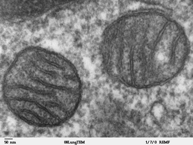 Figure 1.17.b. Diagram and transmission electron micrograph of mitochondria.